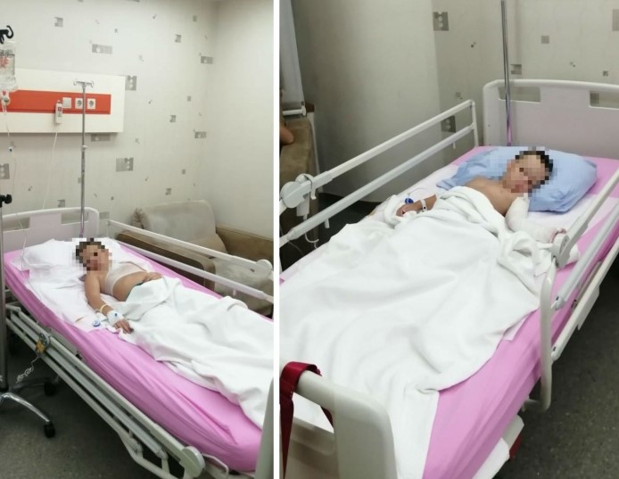В результате несчастного случая мальчики получили ожоги второй и третьей степени