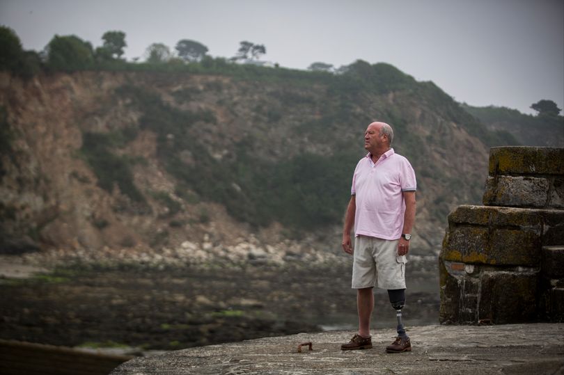 Мужчина натер сандалией мозоль на ноге и лишился голени