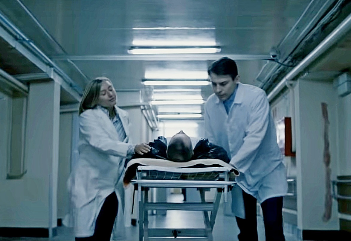 Резкое движение головы привело к инсульту