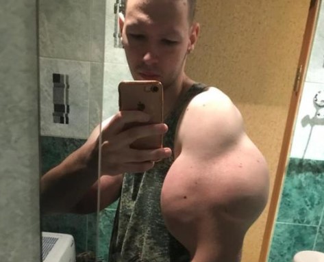 Кирилл Терешин проходит период реабилитации