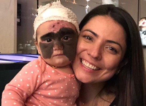 В начале октября американка Кэрол прилетела в Россию вместе с дочкой Луной, чтобы избавить ее от огромного родимого пятна