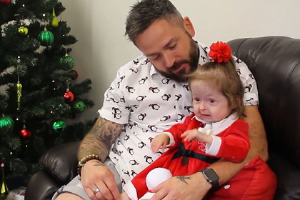 Из-за врожденного заболевания, деформирующего кости, клетки девочки стареют намного быстрее