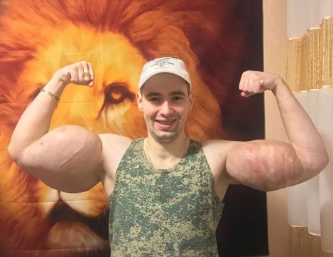 «Отделяя живое от мертвого»: хирург Мельников рассказал, как оперировал Руки-Базуки