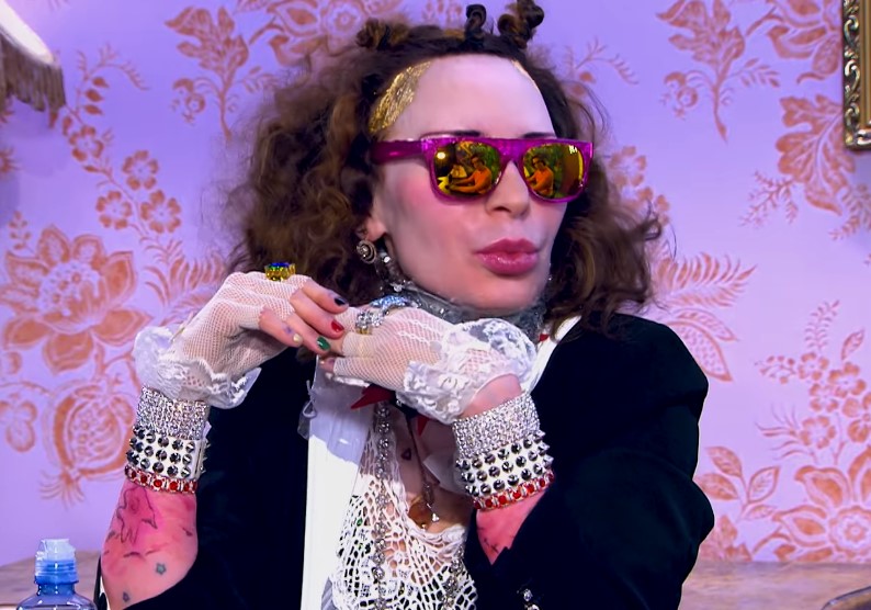 Жанна Агузарова испугала поклонников обездвиженным лицом