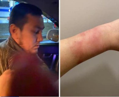 Пьяная москвичка обвинила таксиста в попытке изнасилования и показала синяки