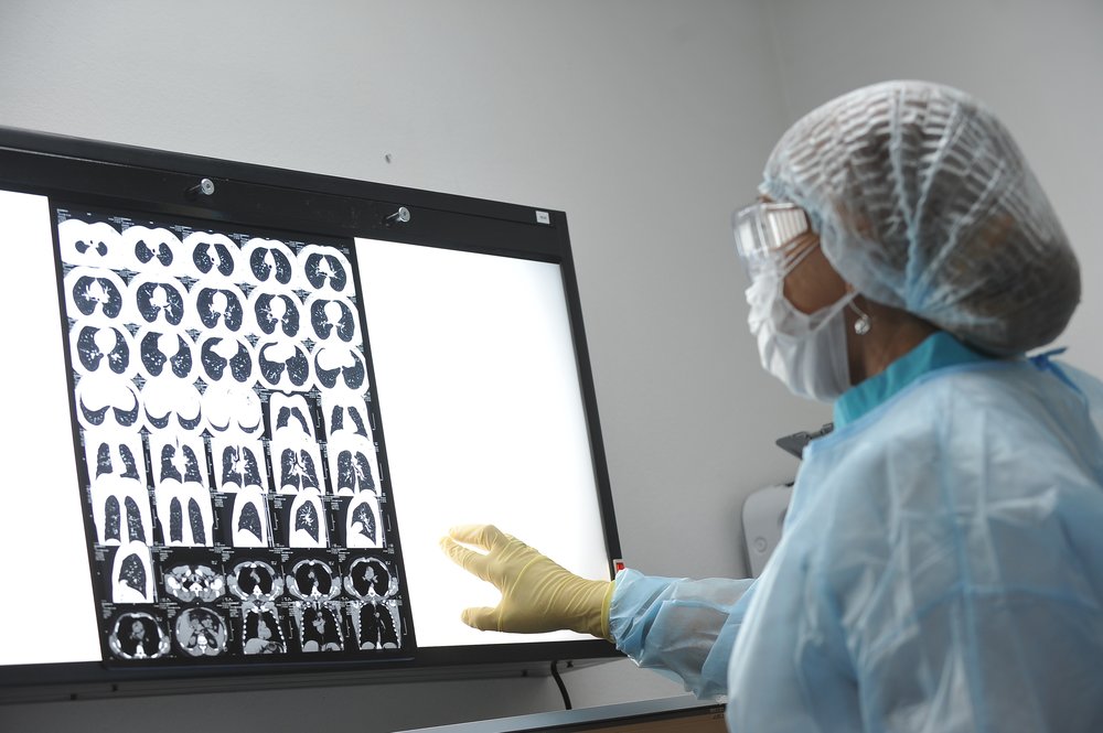 Названы российские регионы с самой высокой заболеваемостью раком