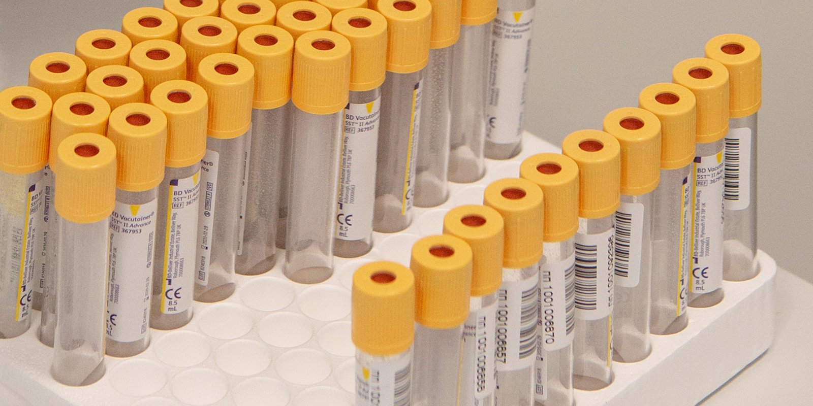 Новый штамм COVID-19 обнаружен в Италии