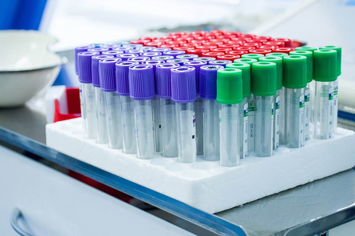 Около 30 сотрудников Центра подготовки космонавтов заболели COVID-19