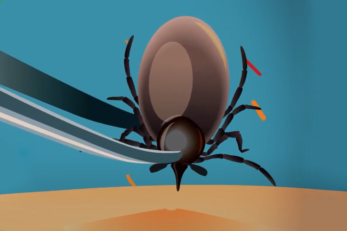 Московские врачи рассказали, как безопасно снять с одежды клеща