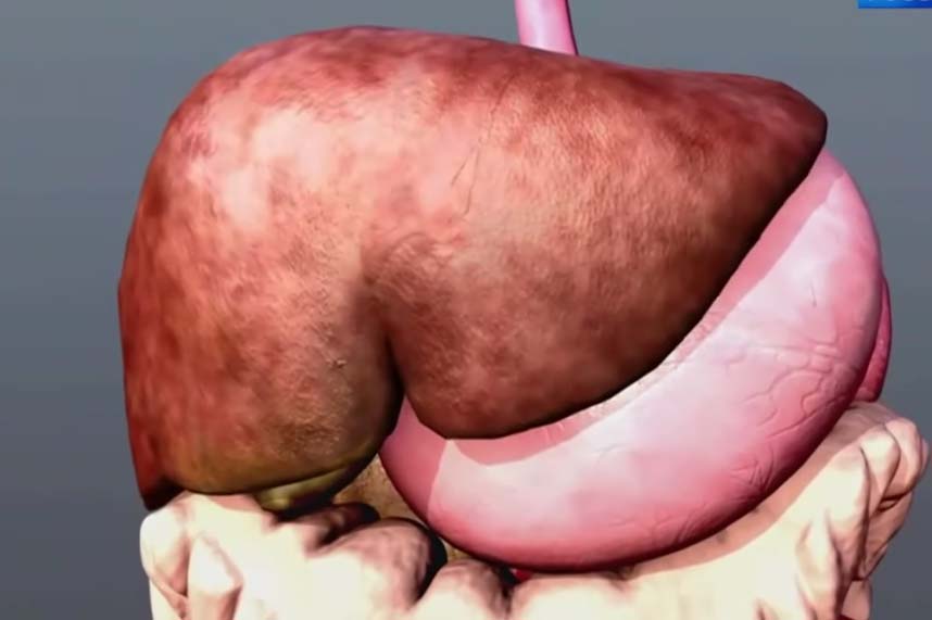 Гастроэнтеролог назвала способ восстановления работы печени без лекарств