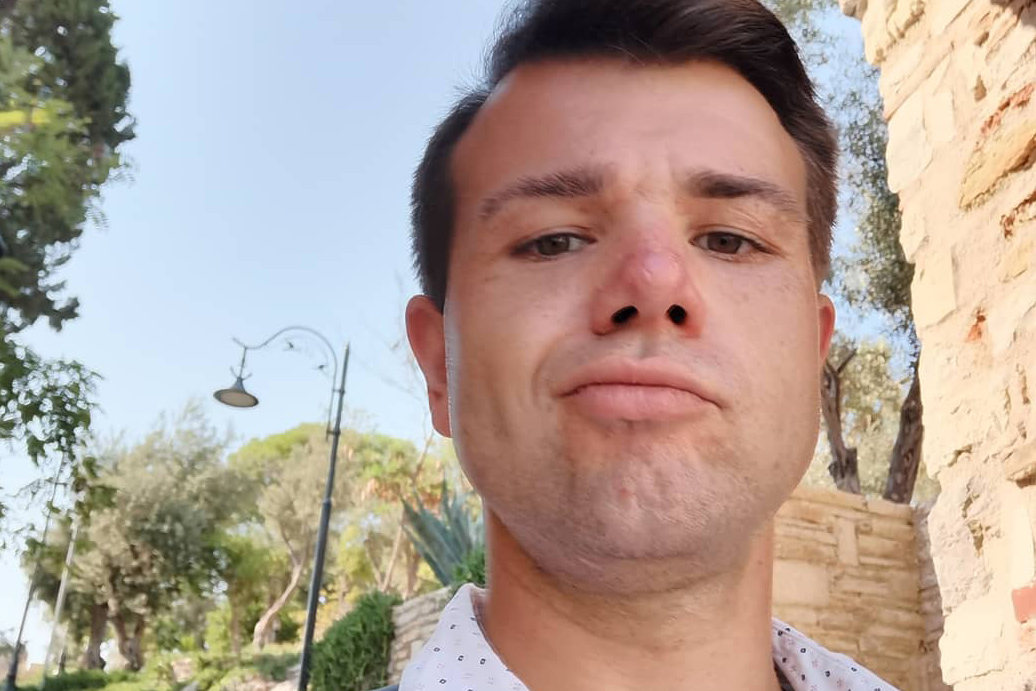 Звезда «Папиных дочек» перенес операцию после падения с высоты 