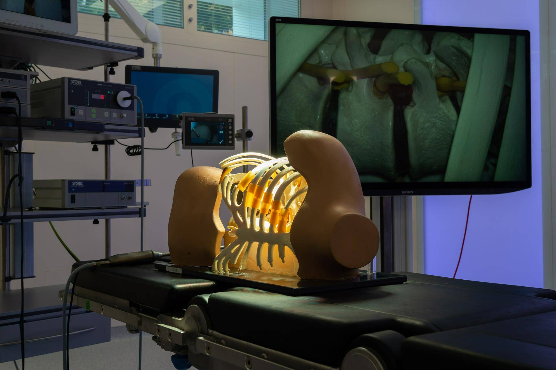 Назван новый подход к лечению сколиоза