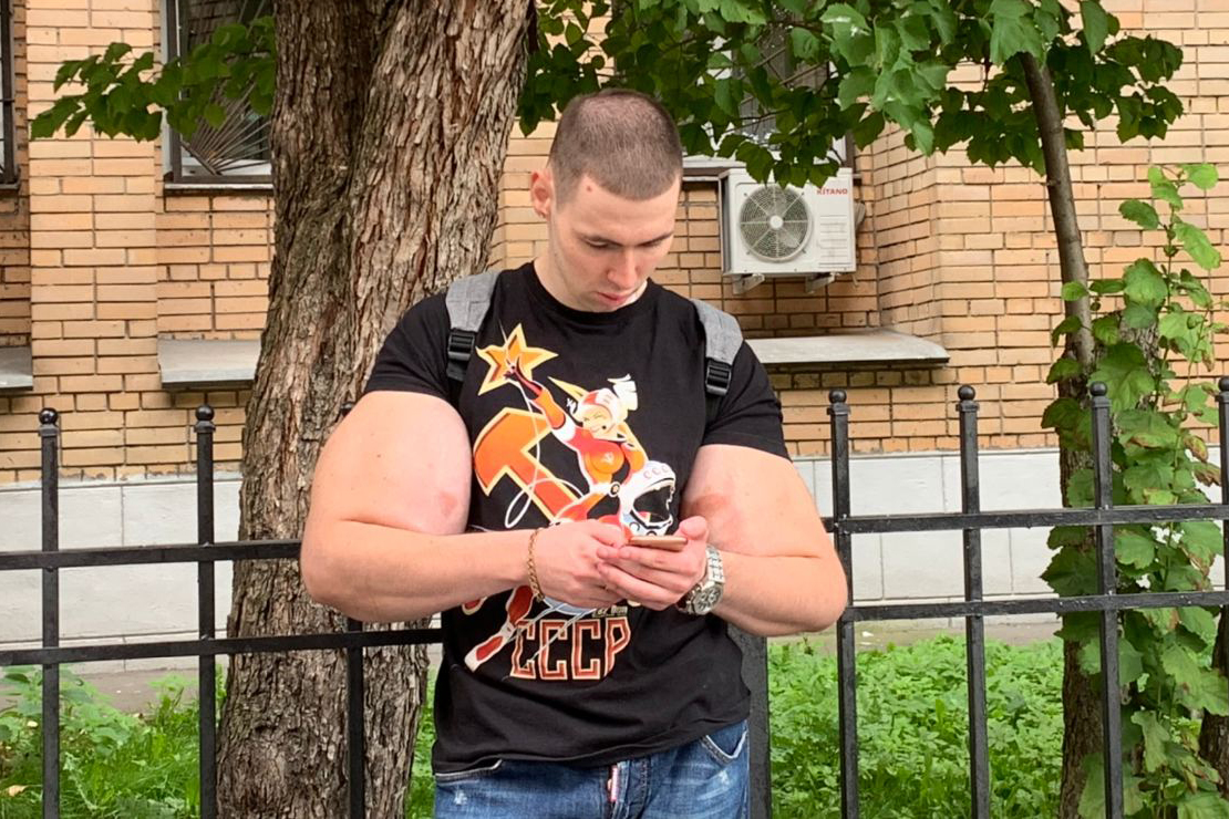 Гниение тканей: Кирилл «Руки-базуки» показал страшные последствия инъекций синтола