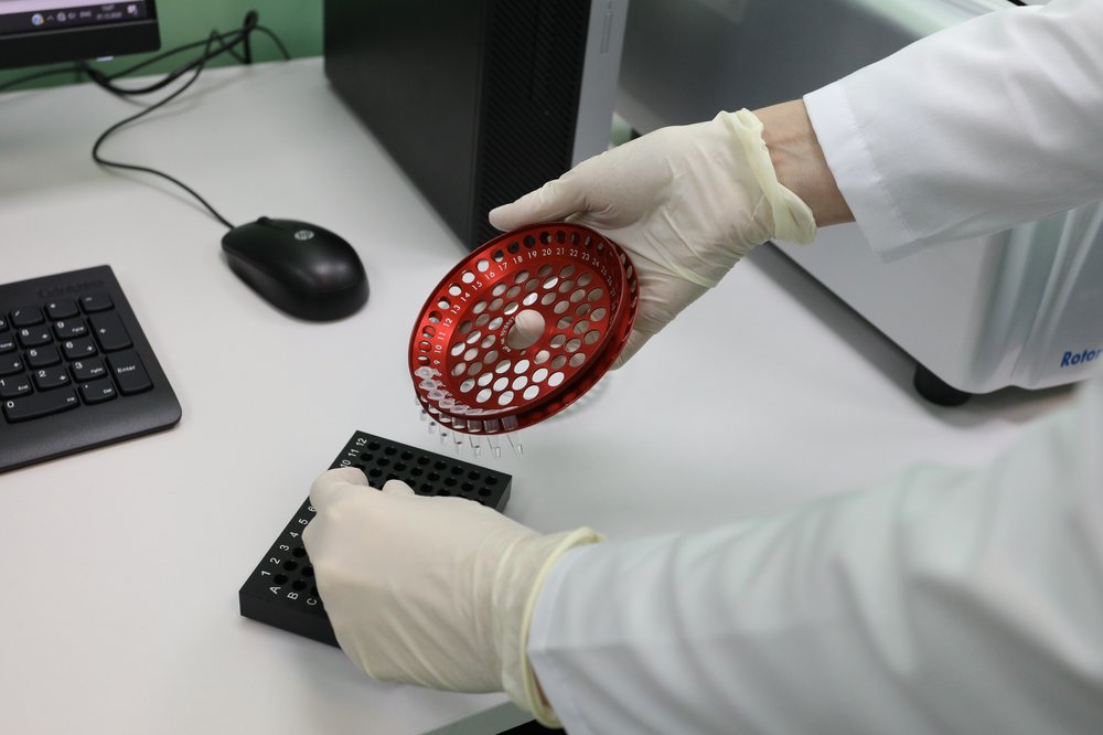 Психотерапевт объяснила причину возникновения страха перед ВИЧ и СПИДом