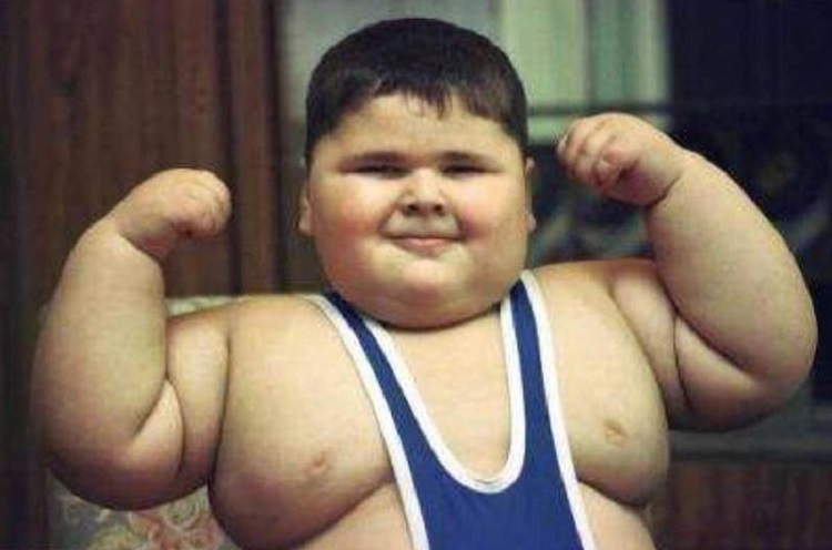 «Самый тяжелый ребенок в мире» умер в России