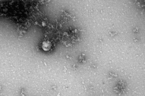 ВОЗ назвала штамм «дельта» COVID-19 самым заразным и быстро распространяющимся