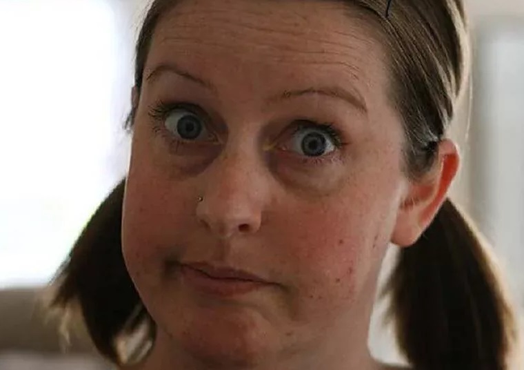 Врач рассказала, на какие заболевания указывают темные круги под глазами