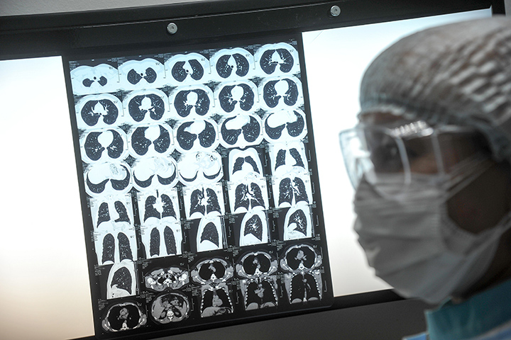 Еще 9167 случаев COVID-19 выявили в России за минувшие сутки