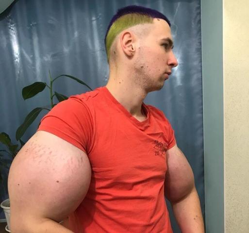 Кирилл Терешин демонстрирует накачанные непонятной смесью бицепсы