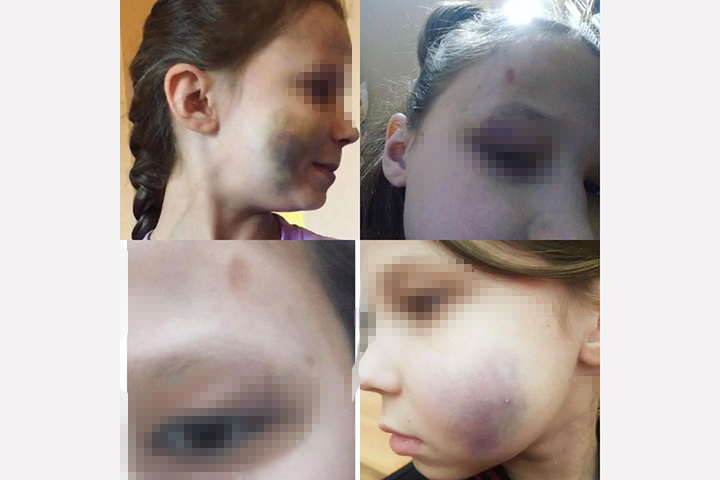 Москвич регулярно избивал свою дочь и кормил протухшей едой