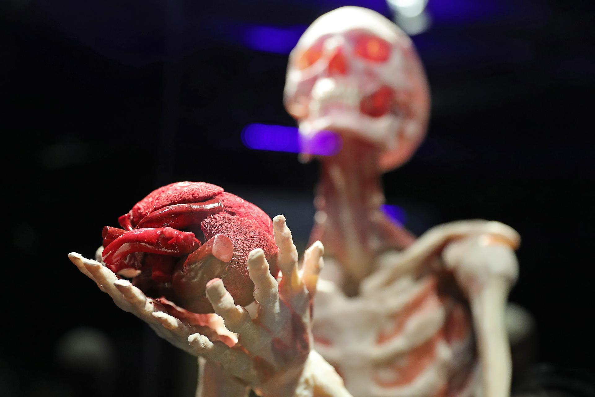 «Путешествие в человеческое тело»: почему следователи взялись за выставку трупов