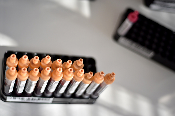 Ученый предупредил, что штамм COVID-19 «дельта» станет доминирующим в мире