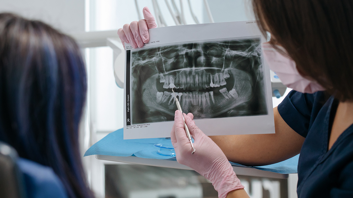 Стоматолог Сумцова назвала болезни зубов, которые на ранних стадиях может найти только врач