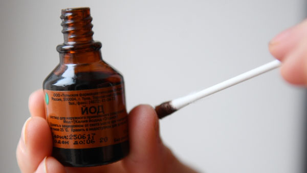 «Это бандитизм!»: врач объяснил, почему запрещено лечиться йодными сетками 