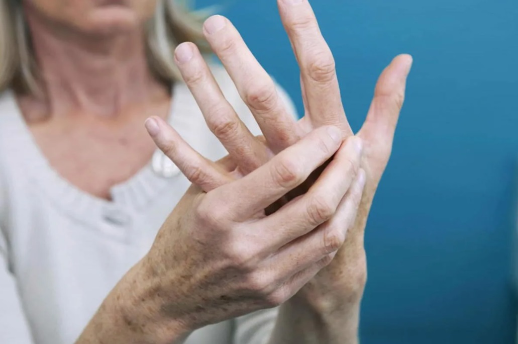 Врачи назвали напиток, помогающий при артрите