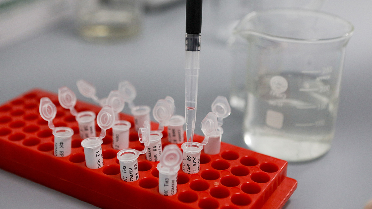 Ученые оценили жизнеспособность штамма «омикрон» на разных поверхностях