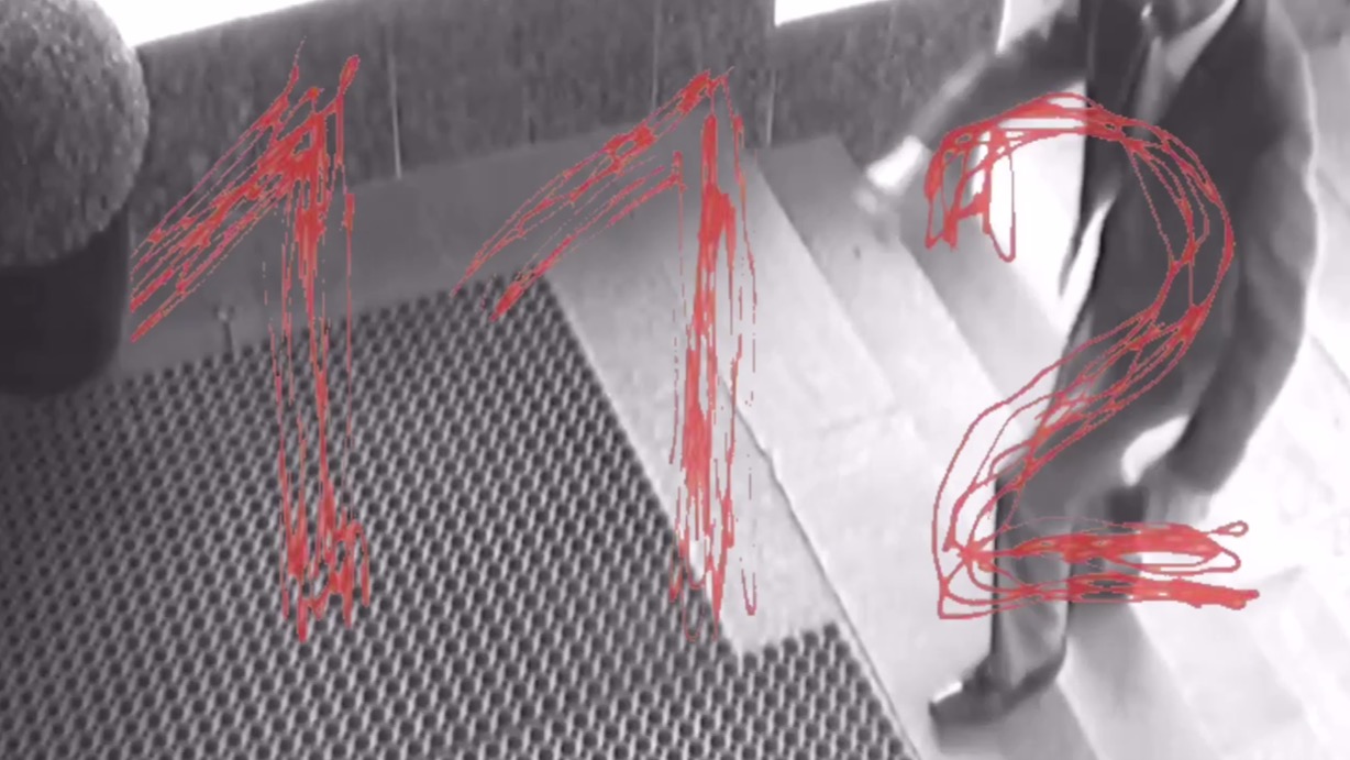 Владелец гостиничного комплекса «Измайлово» пострадал при падении с лестницы