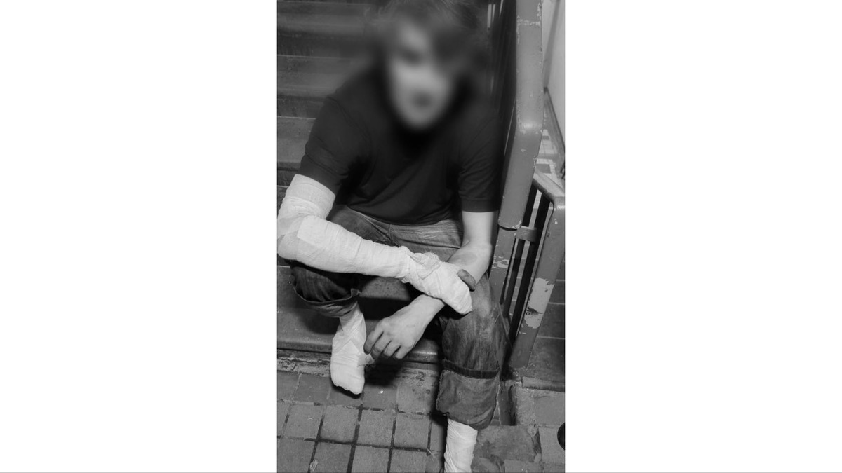 Мужчина в Москве облил супругу горючим и поджег