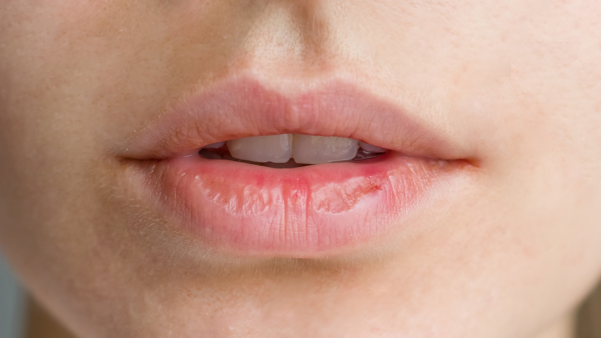 Причины посинения губ