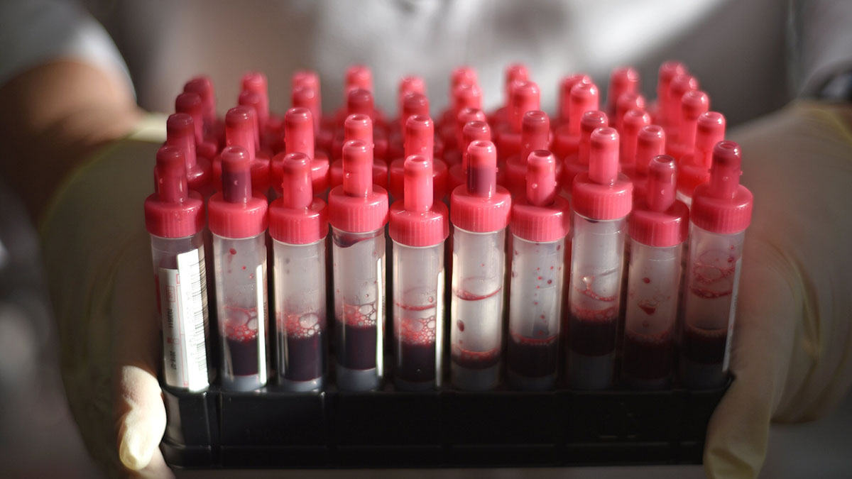 Бесплатная проверка на онкозаболевания пройдет 1 и 2 февраля на трех вокзалах Москвы