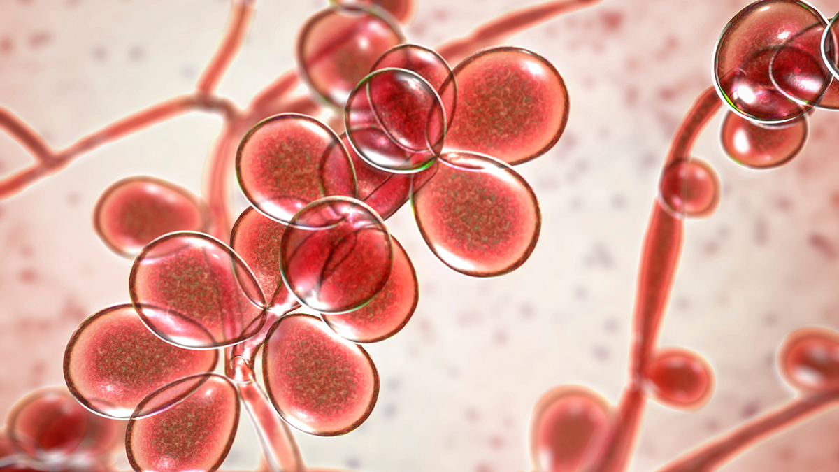 Вспышка золотистого кандидоза: как смертельно опасный грибок связан с  коронавирусом