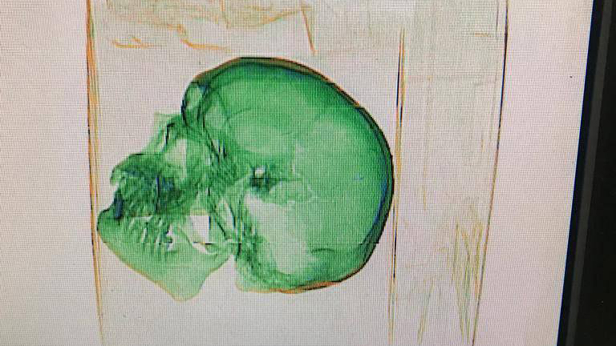 ФТС показала фото черепа, который пытались отправить в посылке в США