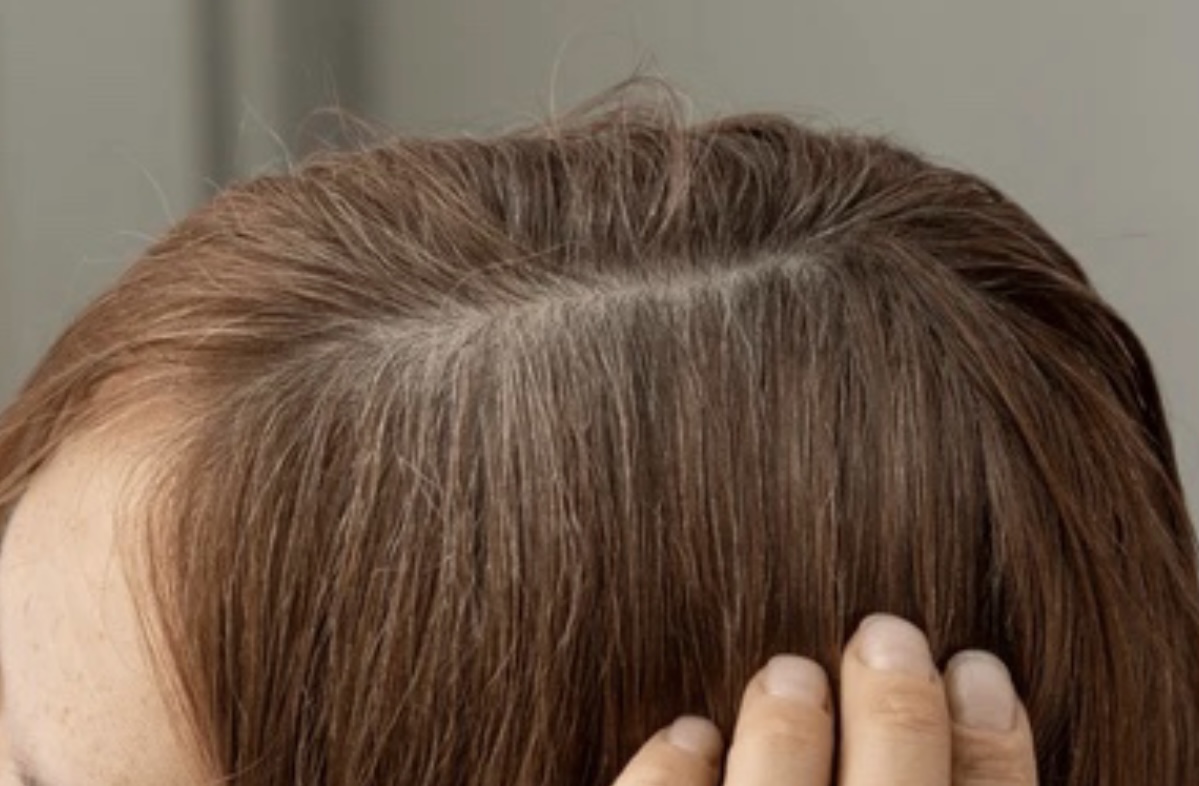 Названы неожиданные ошибки при укладке волос, ведущие к их выпадению