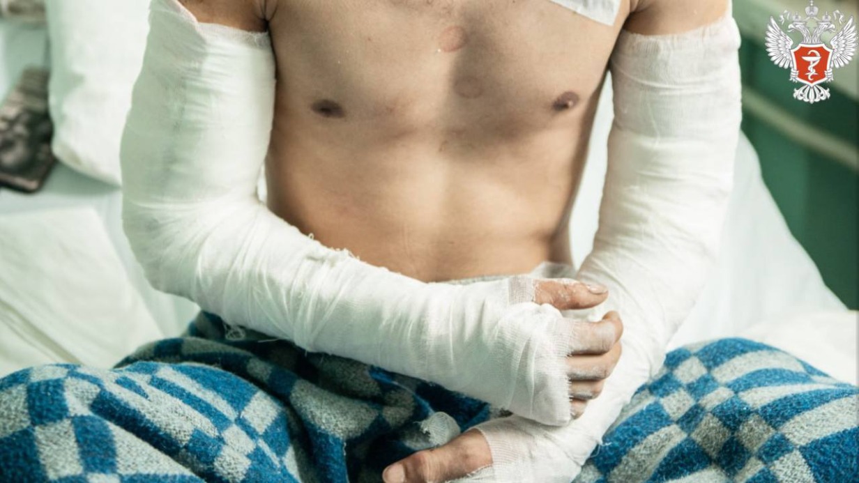 Житель Подмосковья чуть не отрезал себе руки, пытаясь поймать падающее стекло