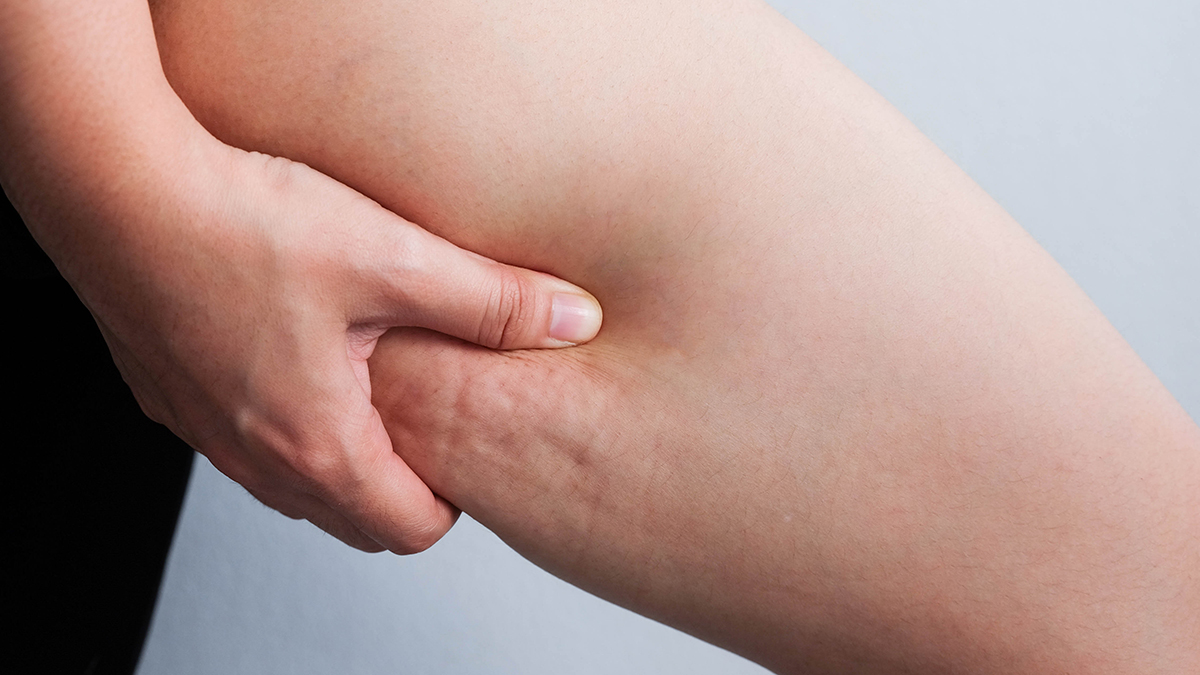 Можно ли с помощью массажа убрать целлюлит