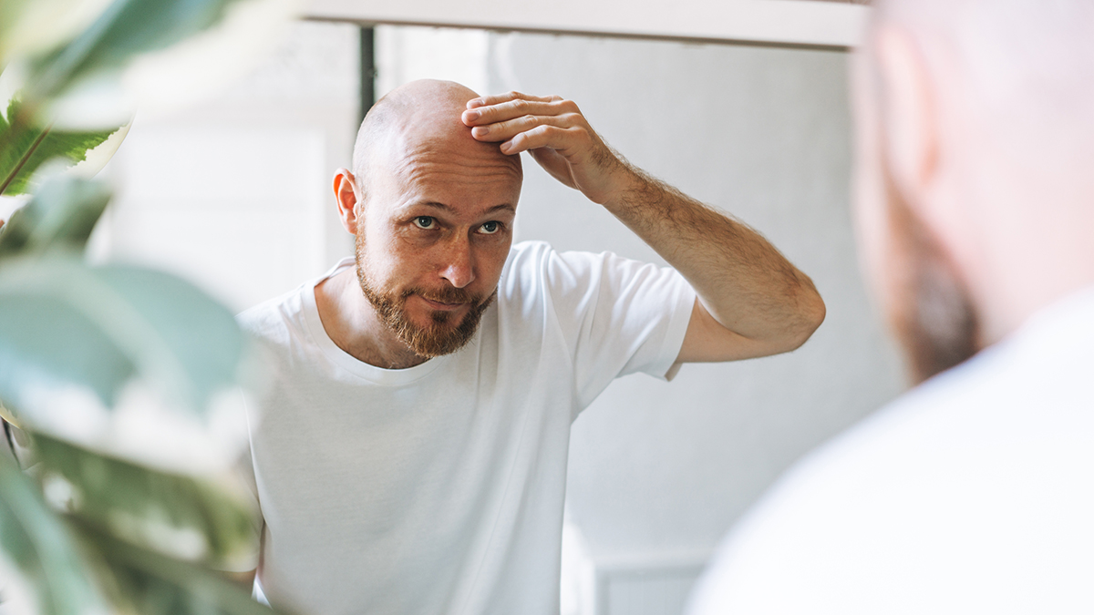 Ученые из Пакистана нашли необычное лекарство от облысения