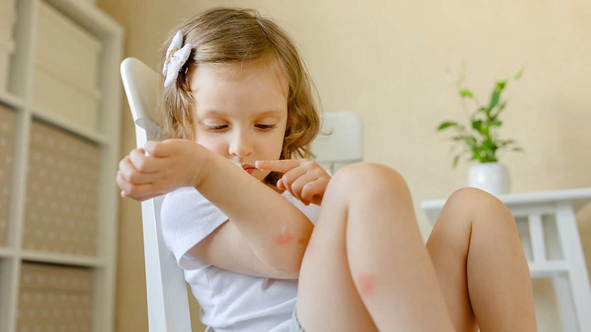 Россияне пожаловались на появление укусов после посещения пляжей Вьетнама