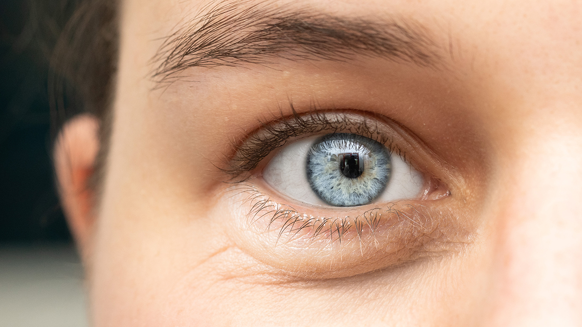 «Вы станете просто вау!»: три самых эффективных способа избавиться от отеков по утрам