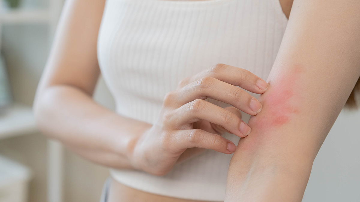 Как ухаживать за кожей при диабете