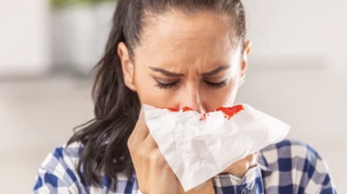«Не запрокидывайте голову»: почему идет кровь из носа и как ее остановить 
