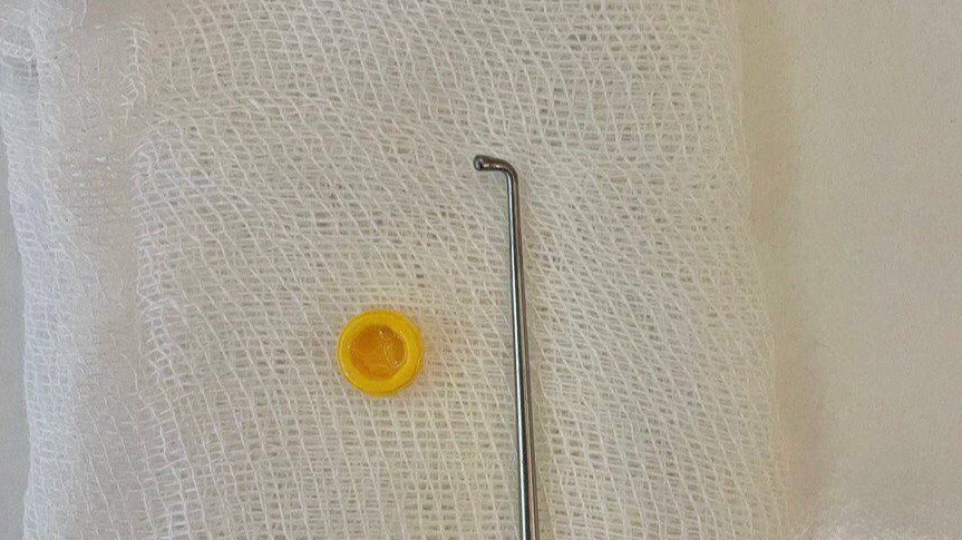 Подмосковные врачи извлекли из носа трехлетнего ребенка деталь конструктора