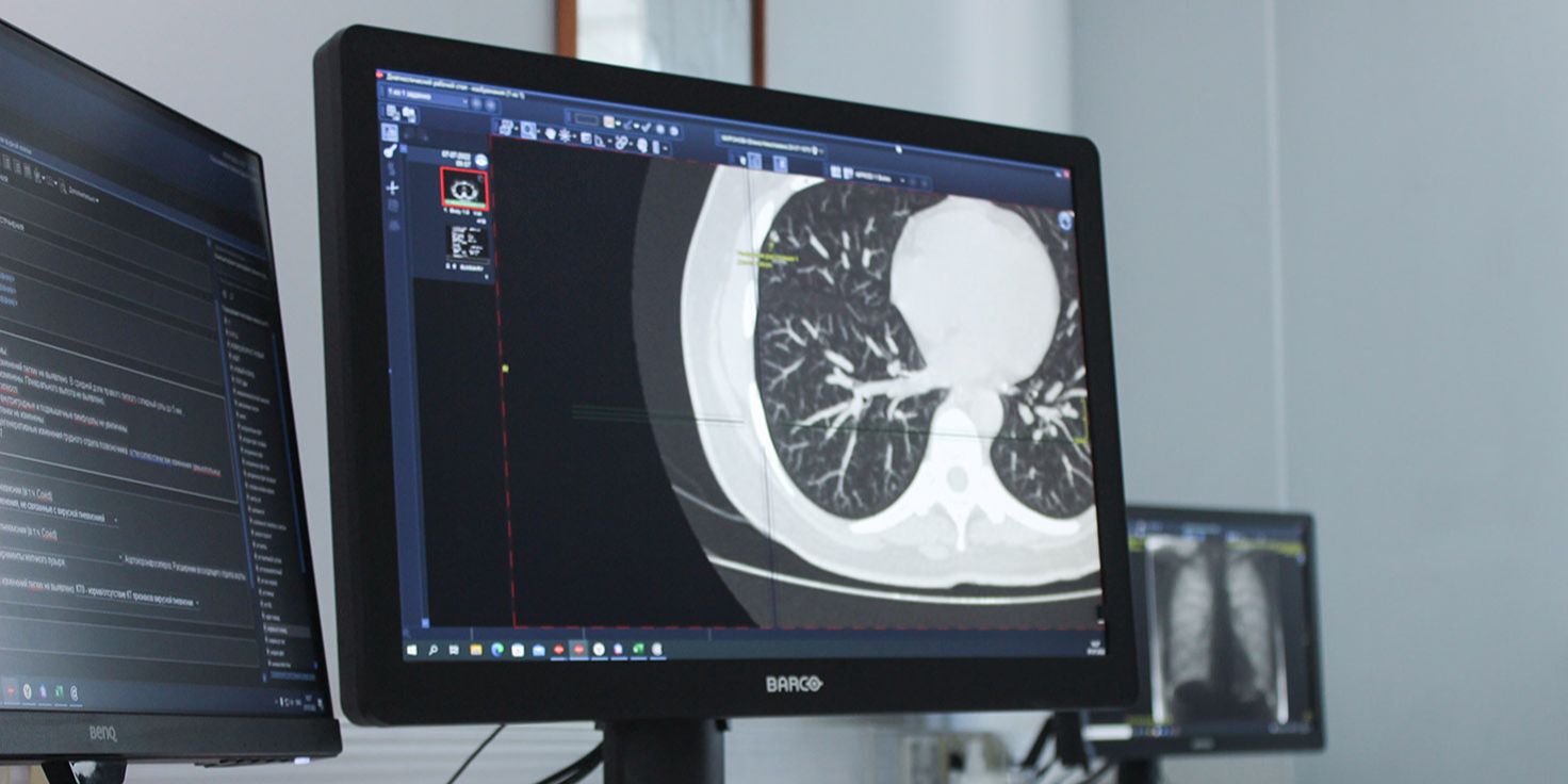 В Москве искусственный интеллект повышает точность анализа снимков и диагностики