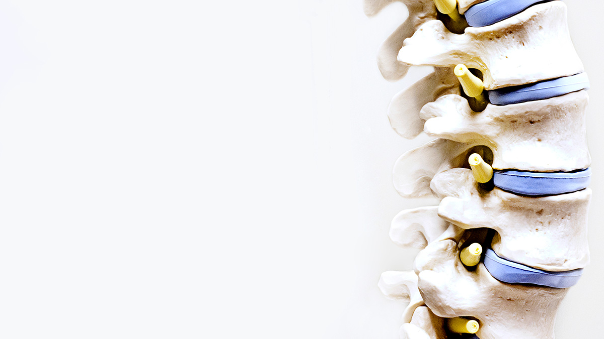 Корсеты для осанки: польза и вред