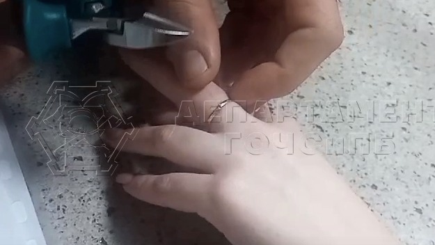 Спасатели помогли москвичке снять с пальца застрявшее кольцо