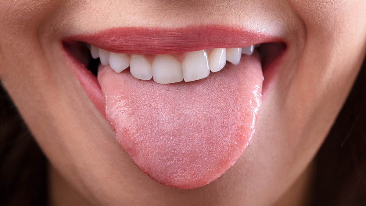 Ученые назвали неочевидный симптом рака, который проявляется на языке