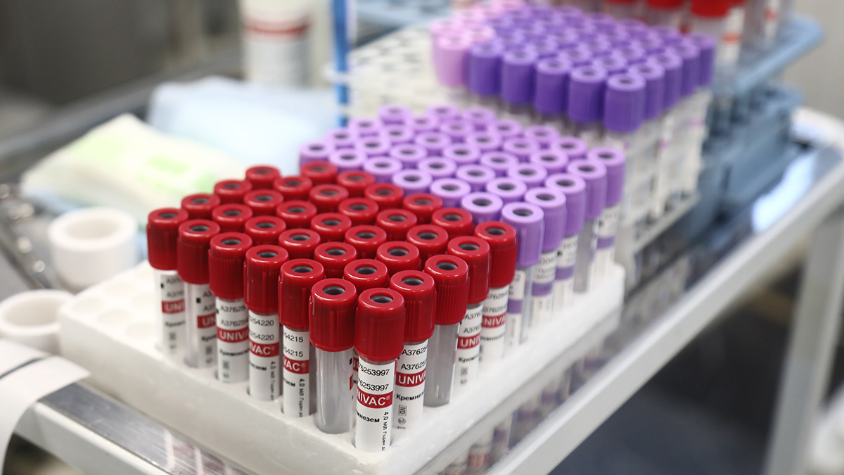 Какие анализы нужно сдать для проверки сердца и сосудов